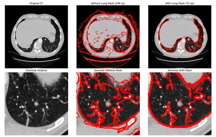 Spectral Clustering on CT Scans – Where Theory Meets Its Limits
